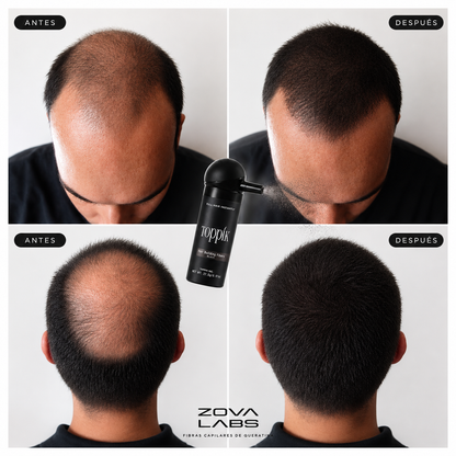 TOPPIK FIBRAS CAPILARES 27,5 g